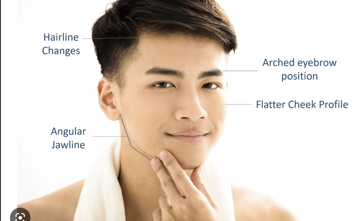 Contour Thread Lift in Hyderabad