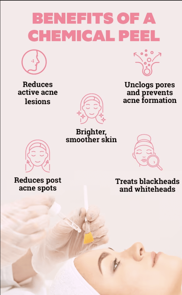 Chemical Peel in Hyderabad