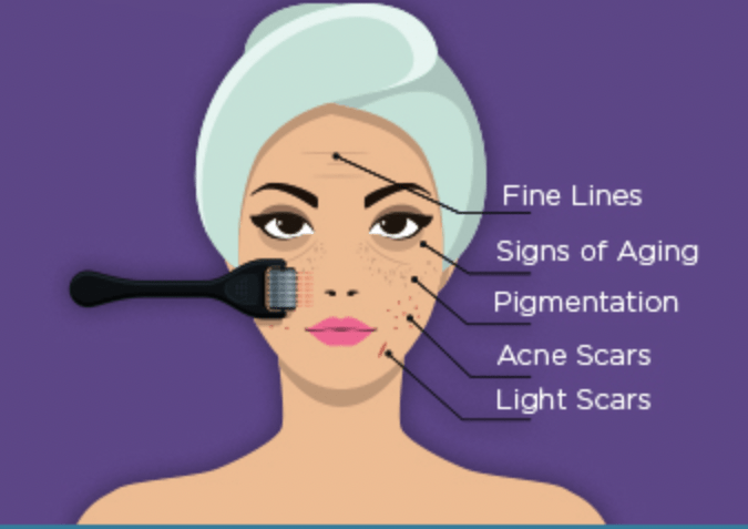 Derma Rollor in Hyderabad