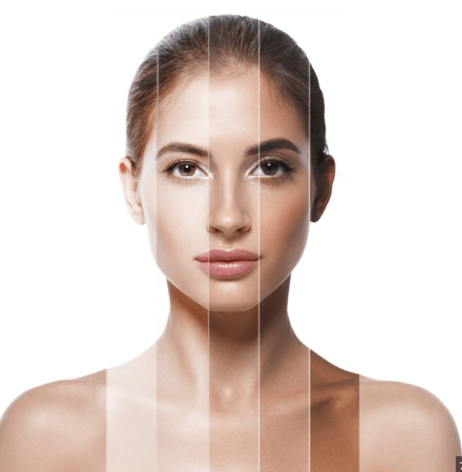 Laser Skin Tonning in Hyderabad