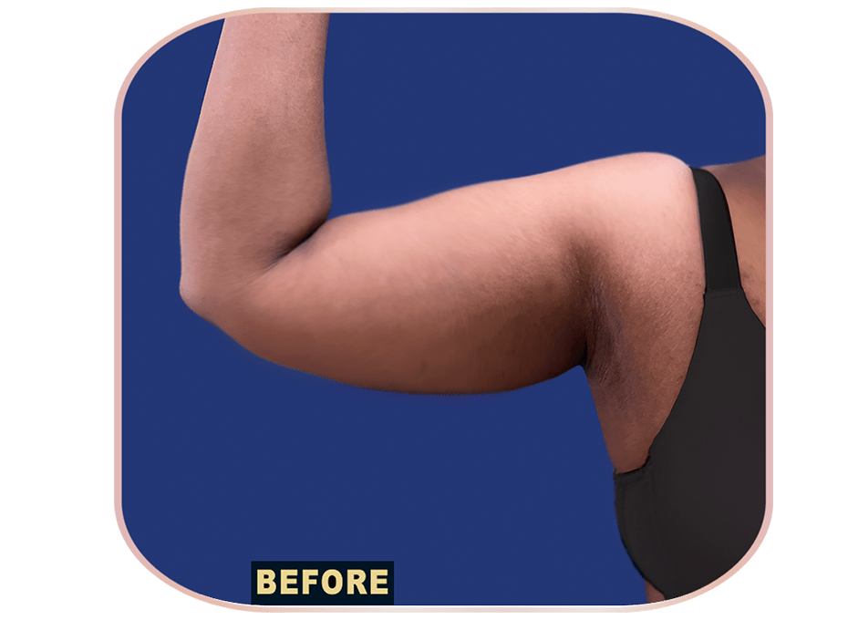 ARM Before