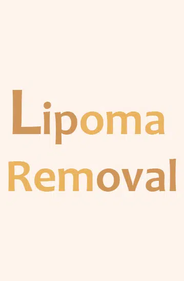 Lipoma removal