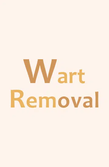 Warts Removal in Hyderabad