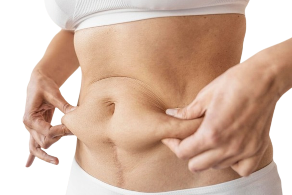 belly fat removal hyderabad