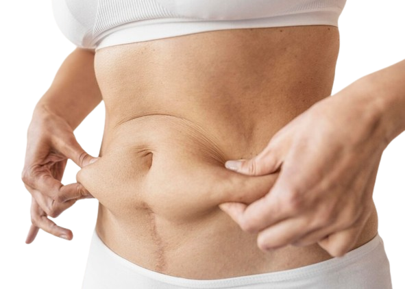 belly fat removal hyderabad