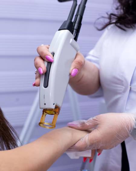 laser hair removal